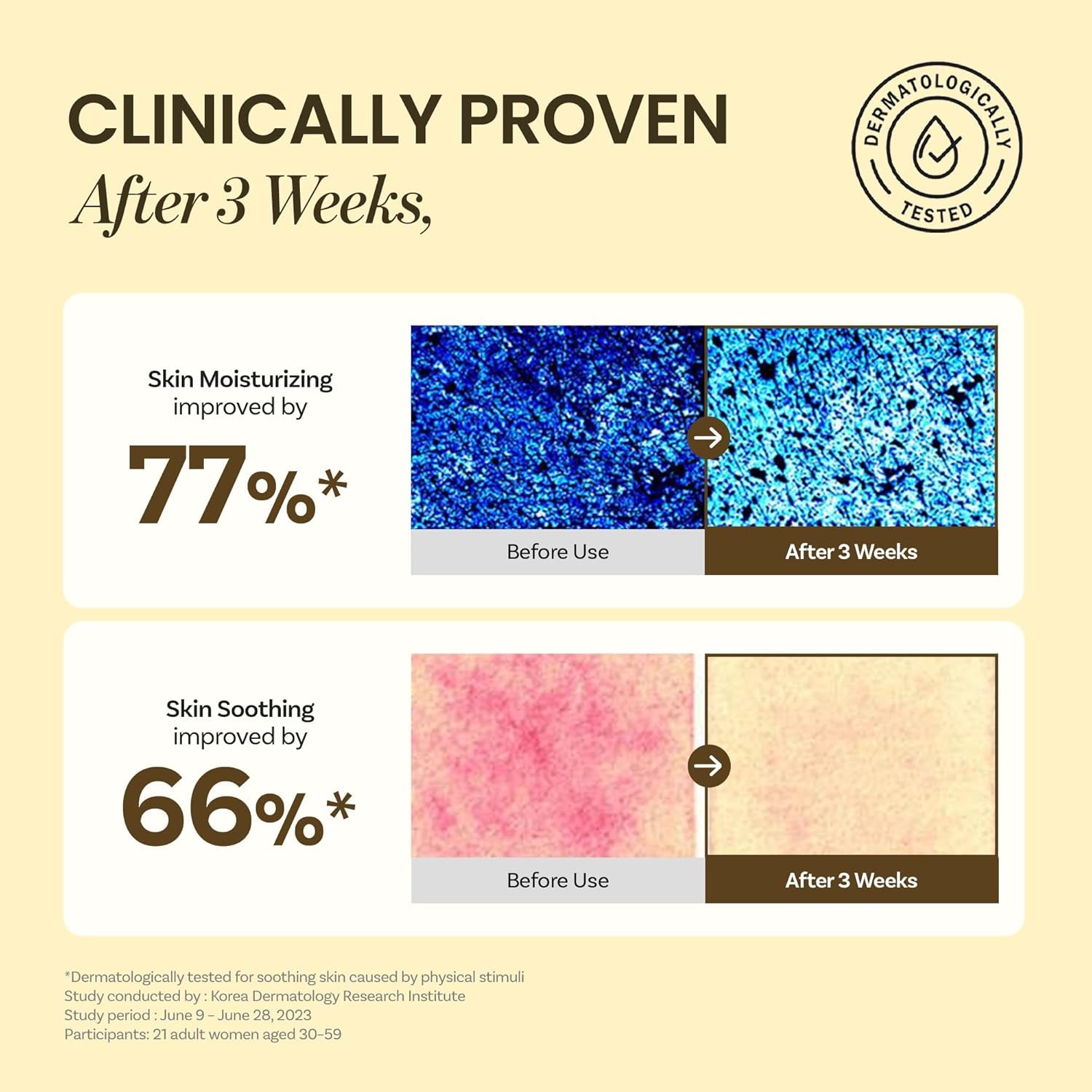 Skin Barrier Calming Lotion | Lightweight Moisturizer for Dry, Sensitive Skin | Centella, 9-Peptide Complex, Glucose, Soothing, Calming, Hydrating | Vegan, Korean Skincare (7.43 Fl Oz)