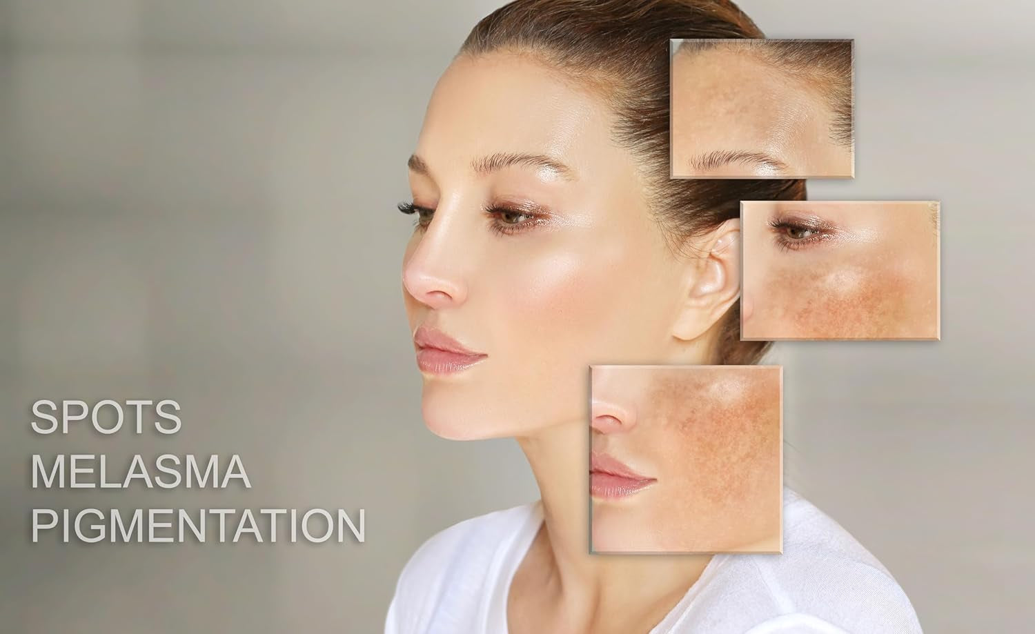 Day Cream Moisturizer for Face Hydration Skincare for Sensitive Skin Acne Treatment and Redness Reducing Moisturizing Facial Cream Rosacea Daily Skin Care Routine Women and Men